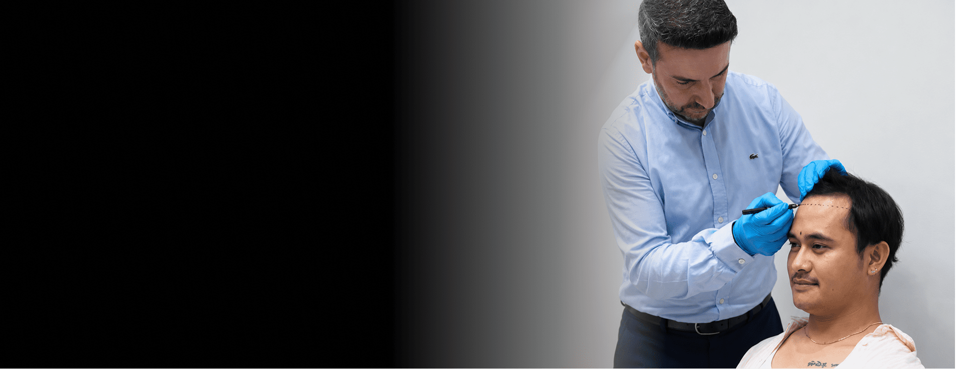 Hair Transplant in Turkey
